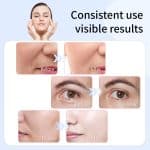 Face Tightening Device