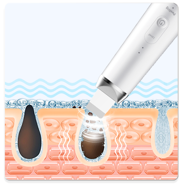 ultrasonic skin scrubbing