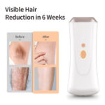 IPL Hair Remover