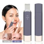 Ultrasonic Deep Pore Cleansing Device