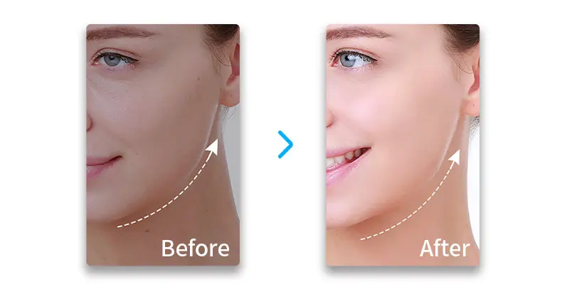 EMS Titanium Face Lifter,EMS Face Lifting Massager