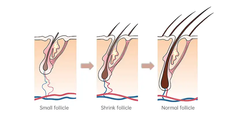 Micro-current Ionic Comb,Red Light Therapy Brushes