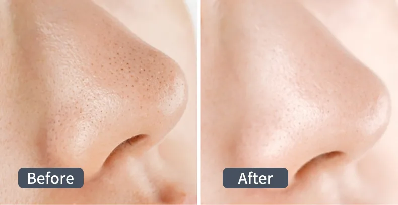 benefits of the ultrasonic skin scrubber