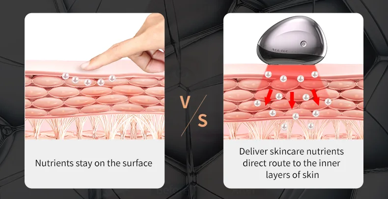 electroporation lead in