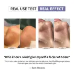 fcb11主图3Ultrasonic Deep Pore Cleansing Device