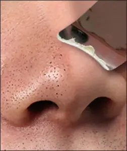 gentle exfoliation without harming the skin