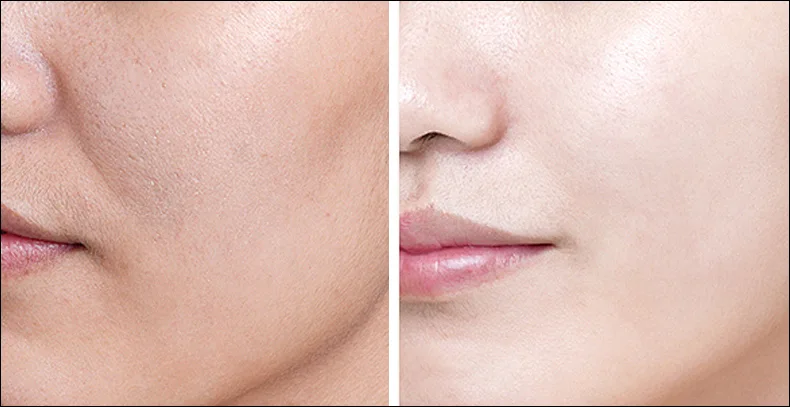 noticeably smoother, softer, and more refined.