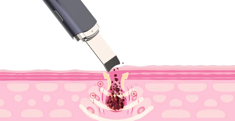 peeling mode blackhead buster