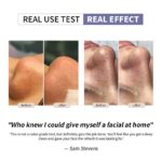 Ultrasonic Deep Pore Cleansing Device