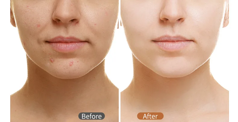 rewrite your skin age