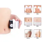 sr 12d主图2 拷贝Electric Cellulite massager