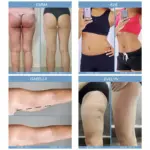 EMS & LIPO Anti-cellulite Massager