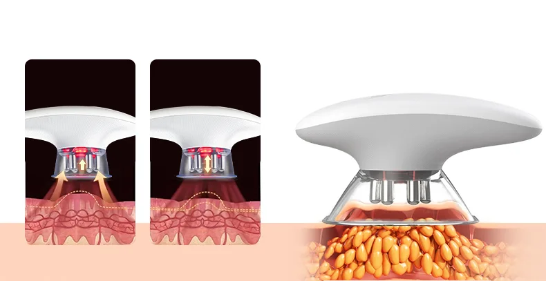 professional vacuum therapy 拷贝