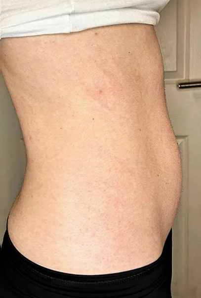 Vacuum Body Contour Device（images 16）