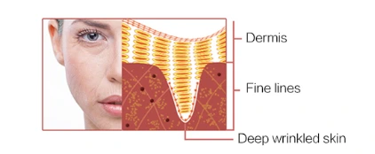 Facial Toning Device（images 11）