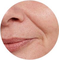 Anti-Aging Firming for Mature Skin