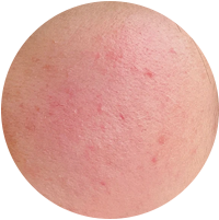 Post-Treatment Repair & Sensitive Skin Soothing
