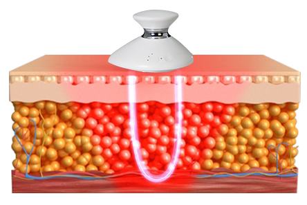 Red Light + Thermal Energy