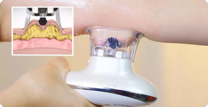 EMS Anti Cellulite Device