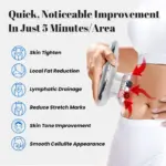 sr 07h主图1 拷贝RF Beauty Device