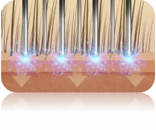 Reactivates Follicle Vitality