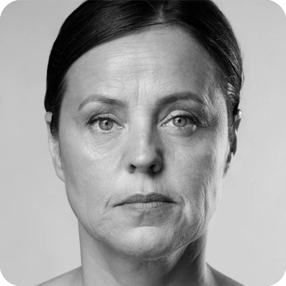 EMS Face Sculpting Tool(images 8)