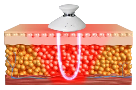 red light + thermal energy2