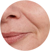 Anti-Aging Firming for Mature Skin