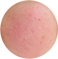 Post-Treatment Repair & Sensitive Skin Soothing