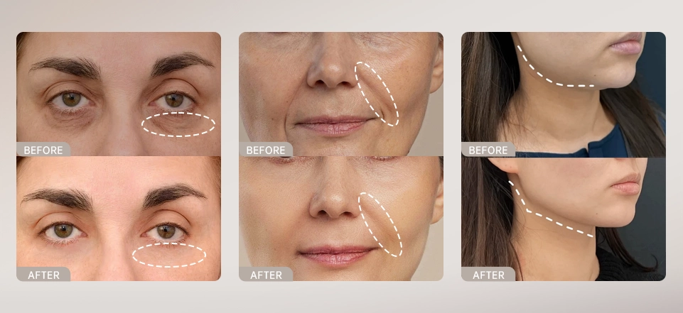 Advanced Face Sculpting Tool for Tight, Radiant Skin &ndash; Perfect for Beauty Brand Partners（images 2）