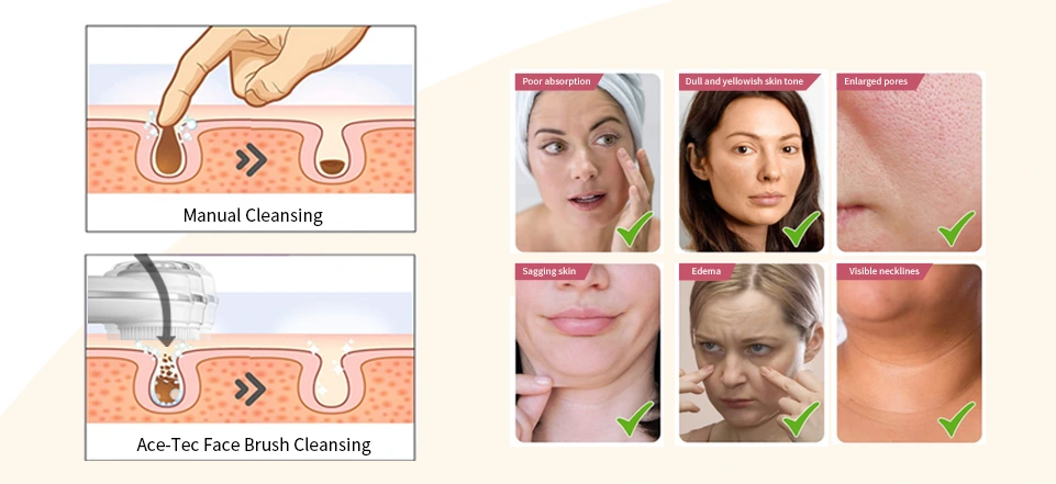 Why a Facial Cleansing Device Matters
