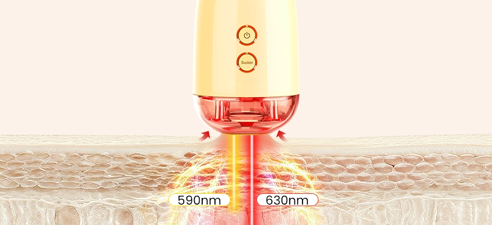 three in one technology for complete facial firming