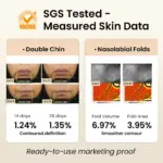 sr 07j新主图5RF Beauty Device