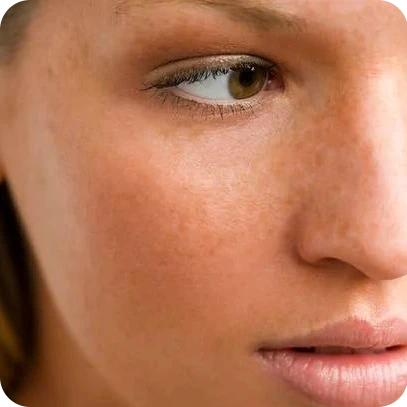 Dull & Tired Skin
