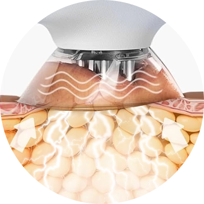 Vacuum Suction & EMS Integration