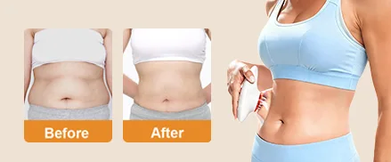 Clinically Tested Body Sculpting Massager: What... Clinically Tested Body Sculpting Massager: What...