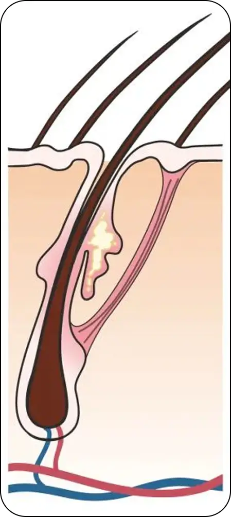 Portable Electric Massage Comb（images 12）