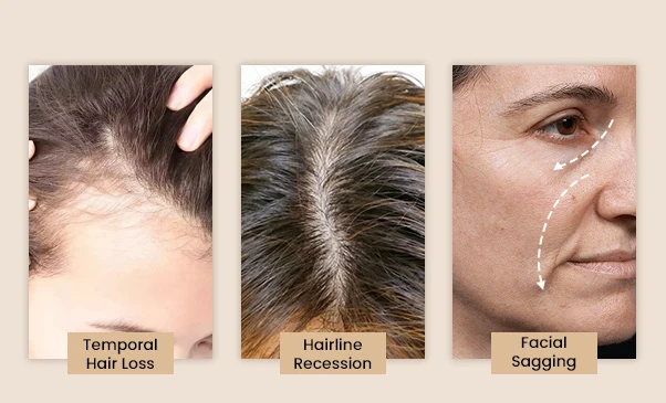 scalp aging issues