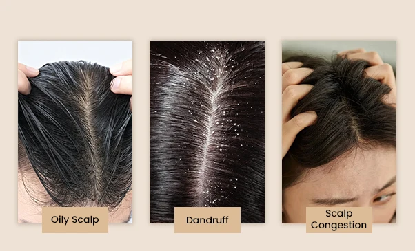scalp health challenges 拷贝