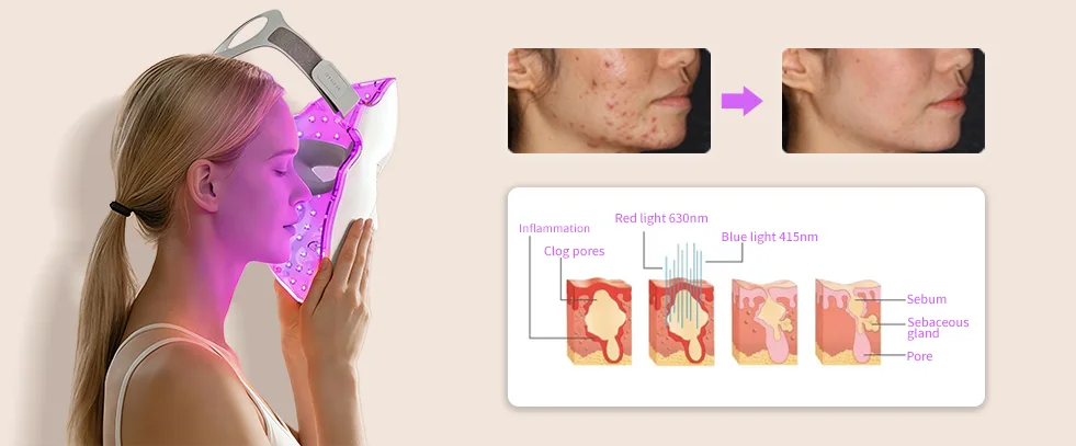 led light face mask 拷贝