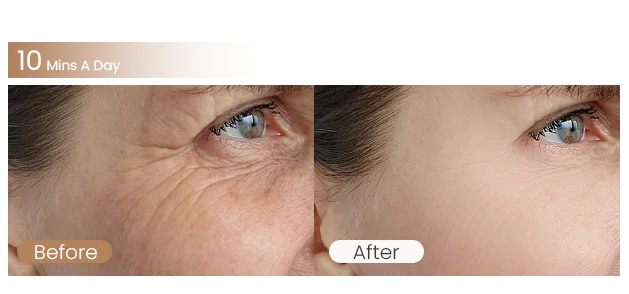 630nm (red) + 830nm (infrared)