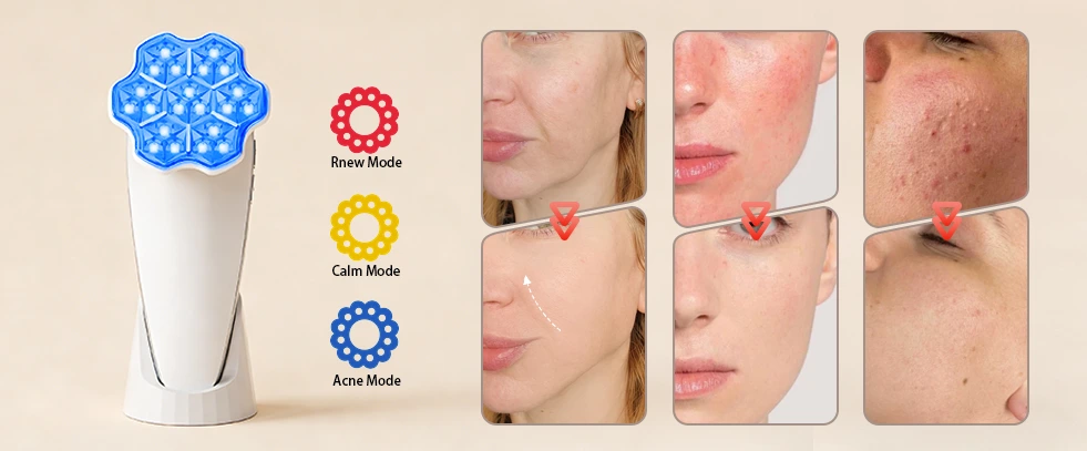 triple spectrum light therapy