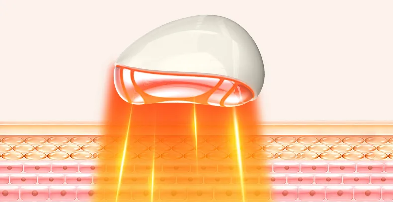 ep+thermal 拷贝